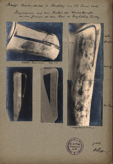fingerabdruck-friedberg fingerabdruck-friedberg